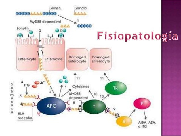 enfermedad celiaca pediatria